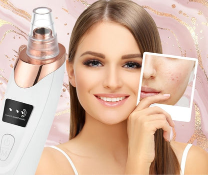 Woman achieving flawless skin after using the Pristine Mornings™ Vacuum Blackhead Remover